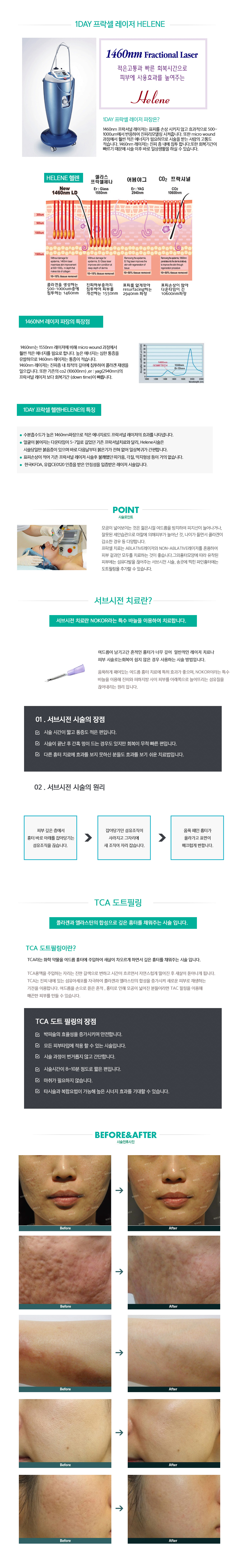 리프팅 컨텐츠