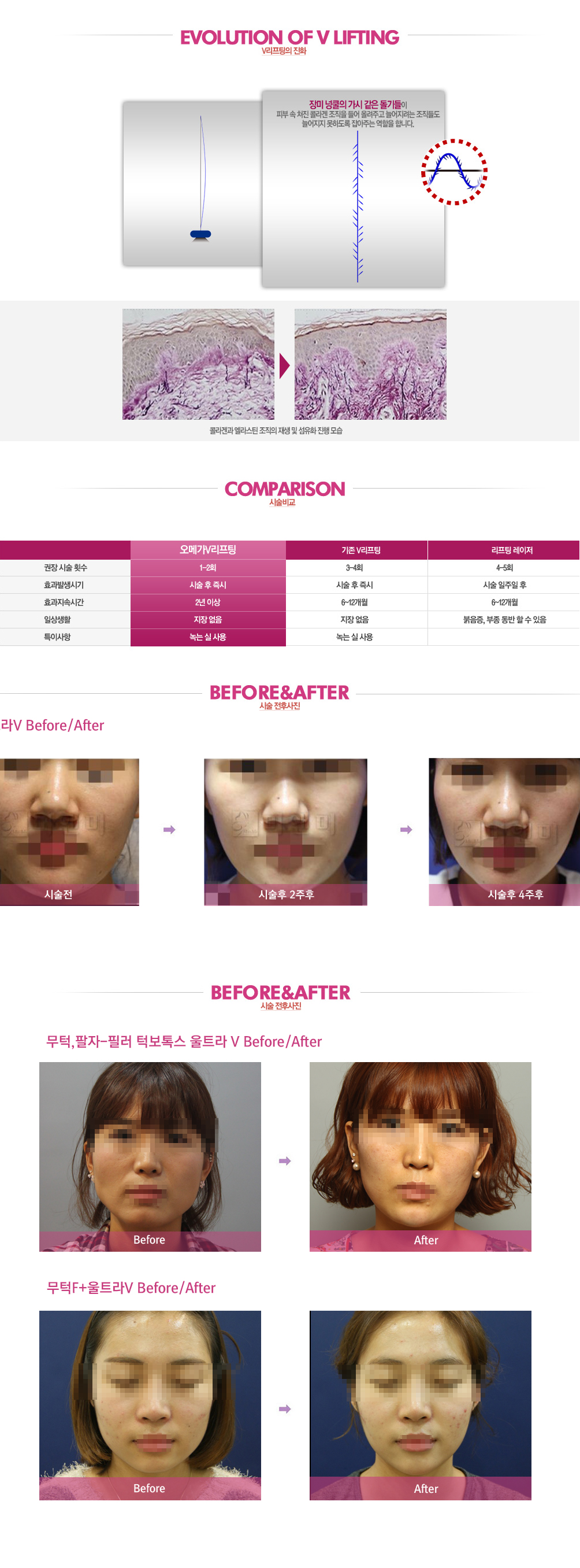 물광주사 컨텐츠